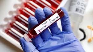 CoronaVirus: उत्तराखंड में सरकार अलर्ट...कोविड लक्षण वाले सभी मरीजों की जांच अनिवार्य, दिशा-निर्देश जारी CoronaVirus: उत्तराखंड में सरकार अलर्ट...कोविड लक्षण वाले सभी मरीजों की जांच अनिवार्य, दिशा-निर्देश जारी